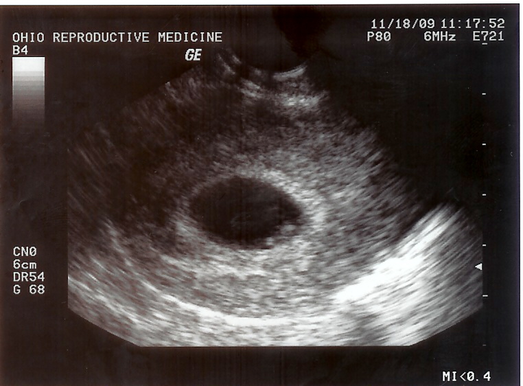 close! baby - look at the little white thing in the circle within the circle