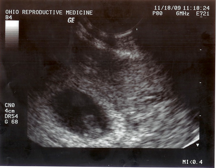 close up of baby